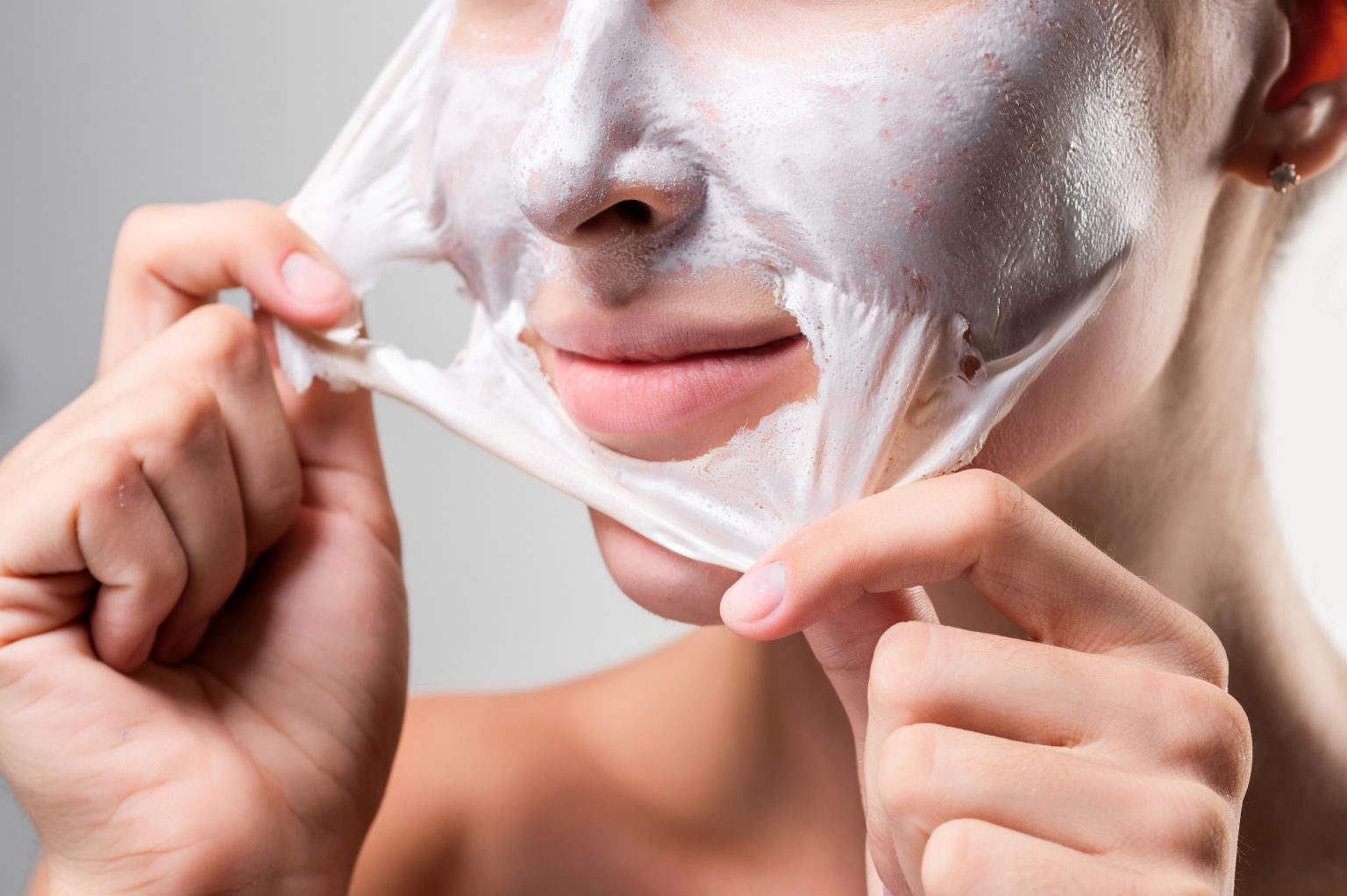 Peeling